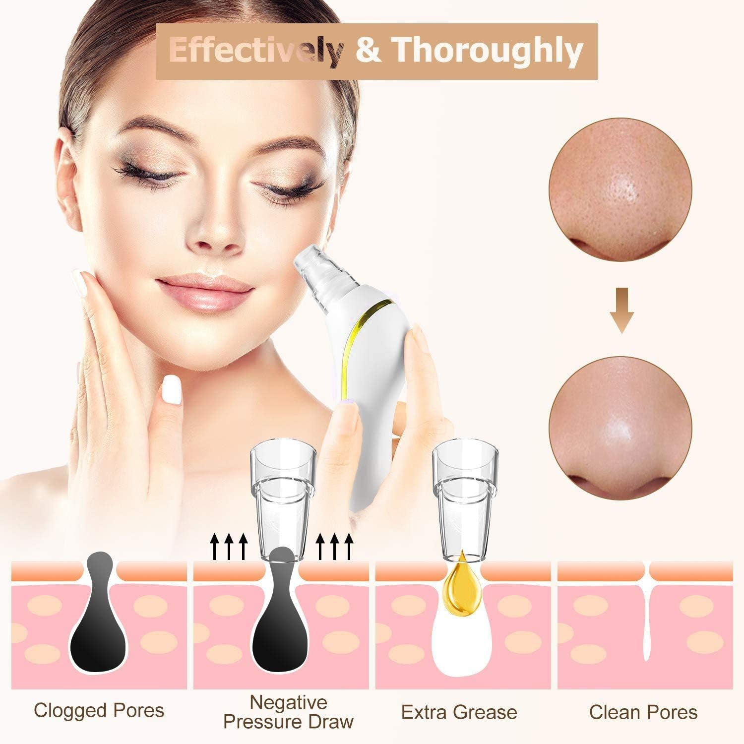 Blackhead Remover Vacuum,  2020 Newest Pore Cleaner Rechargeable 6 Levels Strong Suction Pore Vacuum and 6 Replacement Probes Electric Blackhead Comedone Extractor Acne Removal Tool for Nose Face