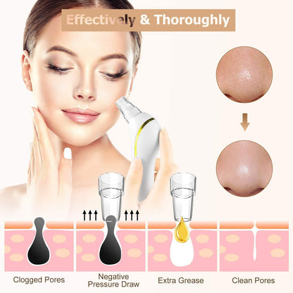 Blackhead Remover Vacuum,  2020 Newest Pore Cleaner Rechargeable 6 Levels Strong Suction Pore Vacuum and 6 Replacement Probes Electric Blackhead Comedone Extractor Acne Removal Tool for Nose Face